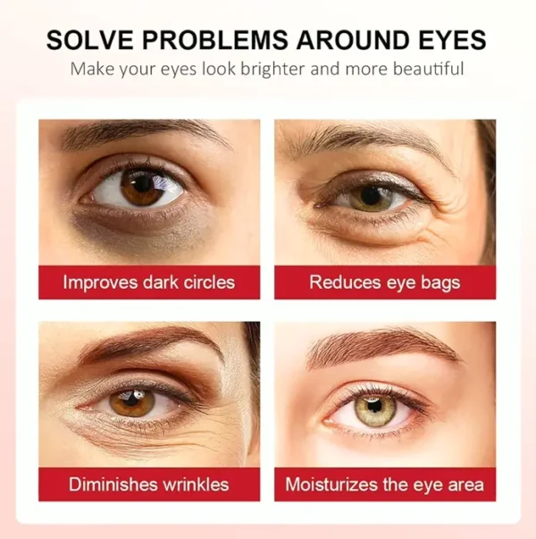 Vitamin A Eye Balm - Peptides & Hyaluronic Acid, Anti-Aging Eye Cream