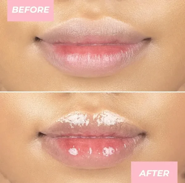 MCo Beauty Hydrating Lip Treatment for Beautiful Lips