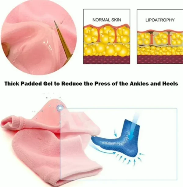 Ultimate Cracked Foot Treatment Gel Socks 2-Pairs