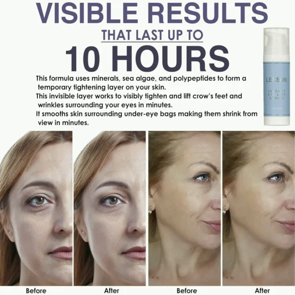 Instant Eye Lift Treatment - Visible Results for Lines & Wrinkles