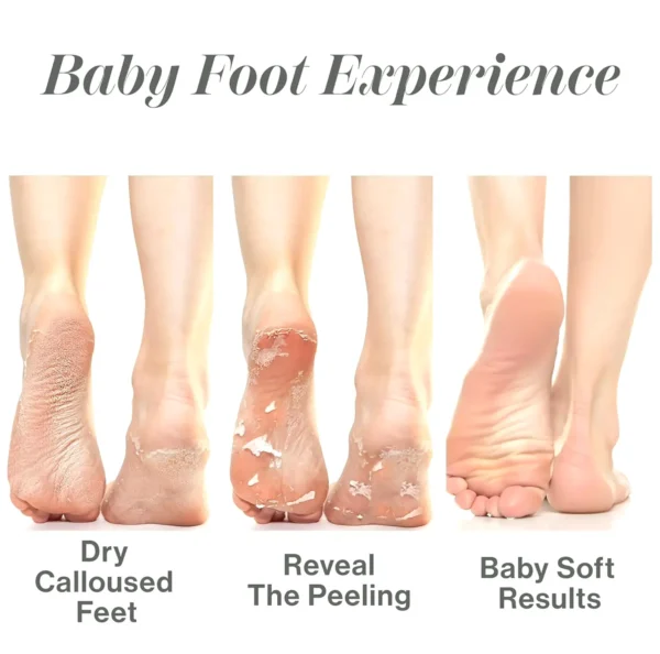 Infant Feet Peeling Mask - Floral Scent
