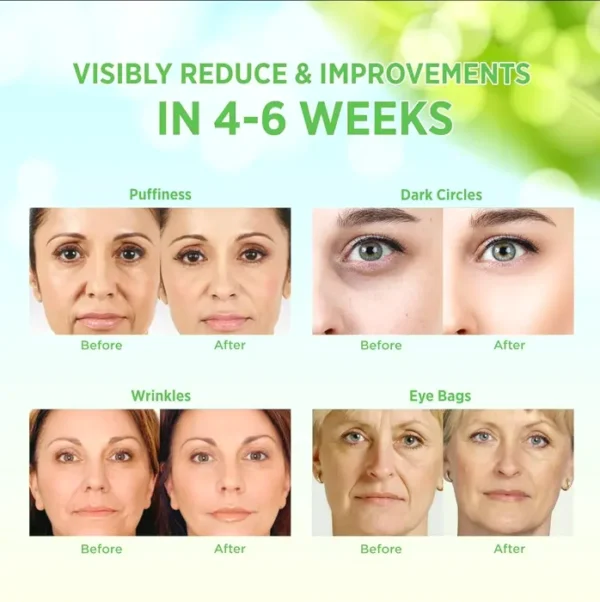 VELAMO Aloe Vera Under Eye Patches for Wrinkles