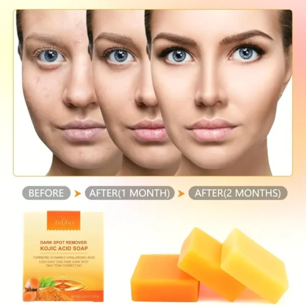 Inlife Kojic Acid Cleanser Spot Eliminator