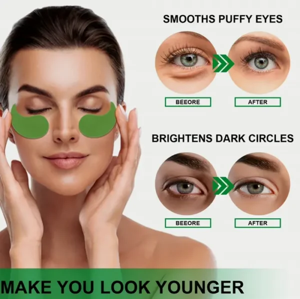 Under Eye Masks for Reducing Under-eye Circles, Edema, and Puffiness