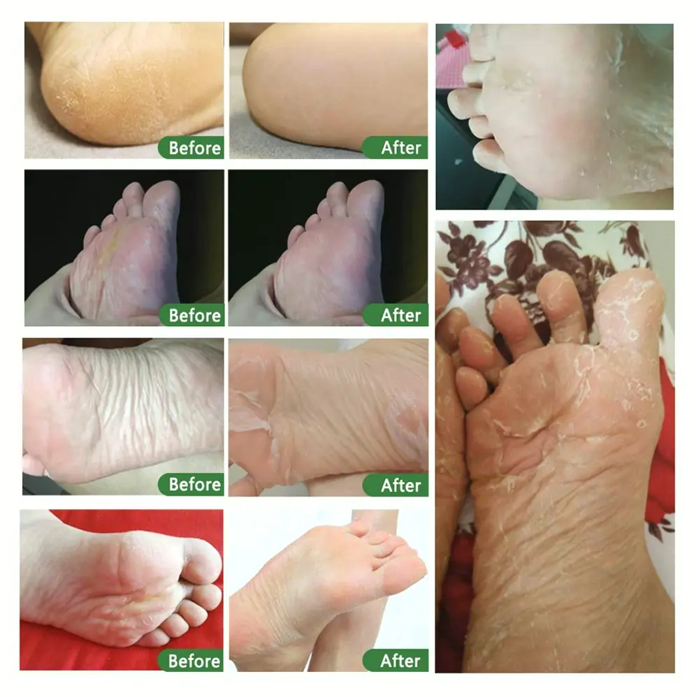 Feet Exfoliating Mask - 5Pk, Baby Feet Repair