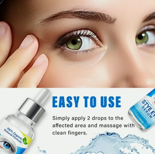 Chalazion Vision Treatment Serum for Fast Efficacy
