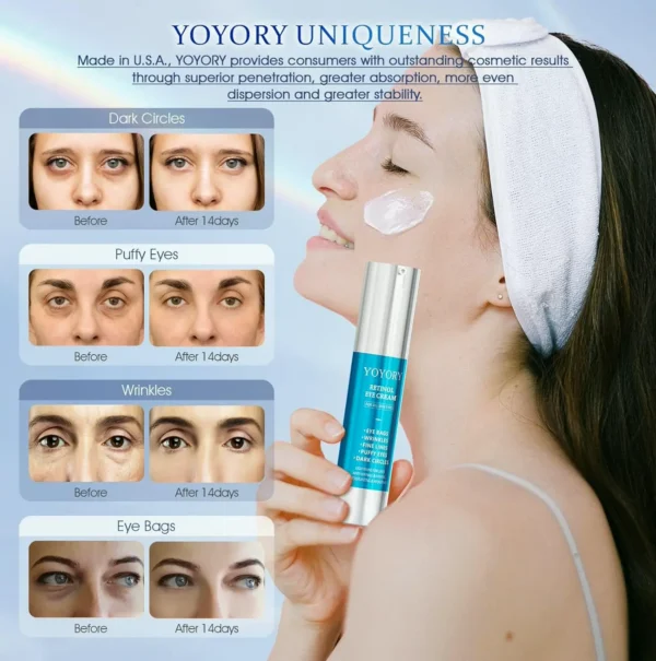 Vitamin A Under-Eye Treatment - Anti-Aging Eye Solution for Shadows and Swelling (Small Size)