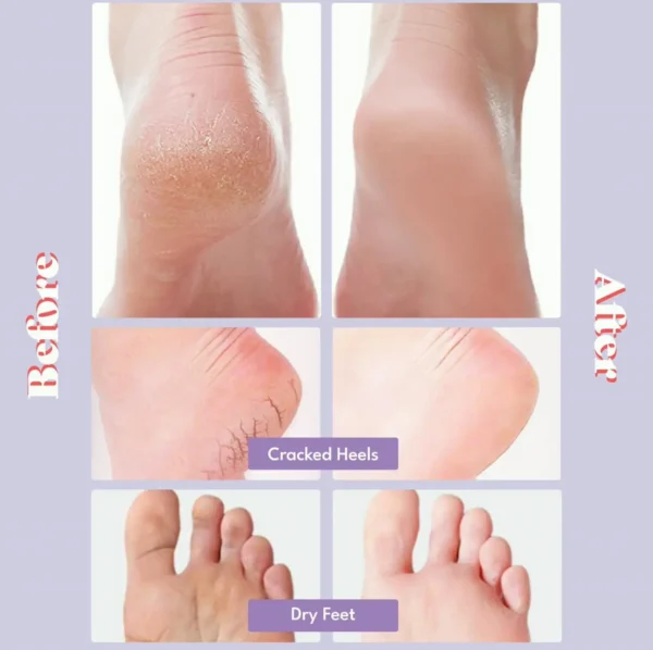 Super Smooth Feet Pack Treatment - 5 Pairs