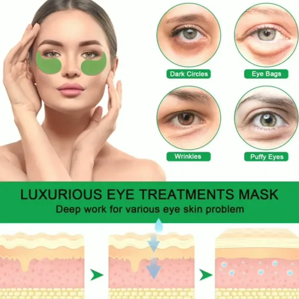 Under Eye Masks for Reducing Under-eye Circles, Edema, and Puffiness
