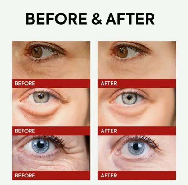 VELAMO ADVANCED Eye Cream for Wrinkles & Dark Circles - 15g