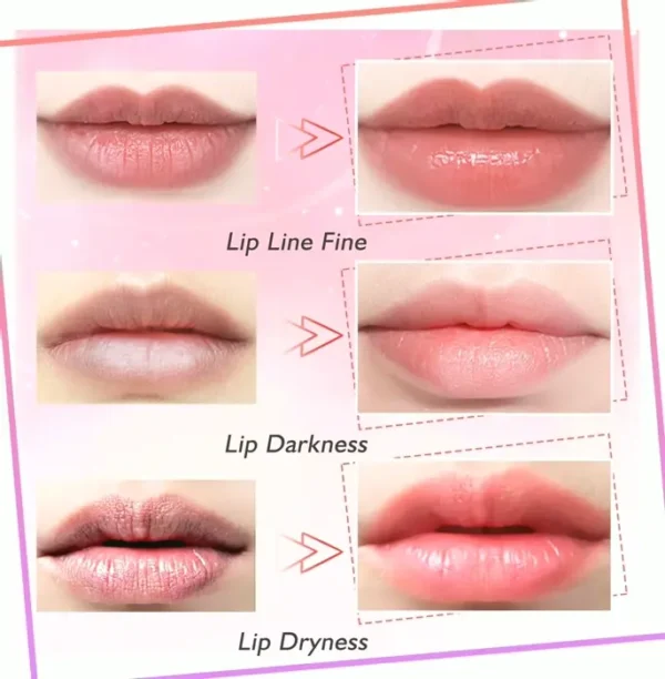 Collagen Lip Masks - Moisturize & Plump